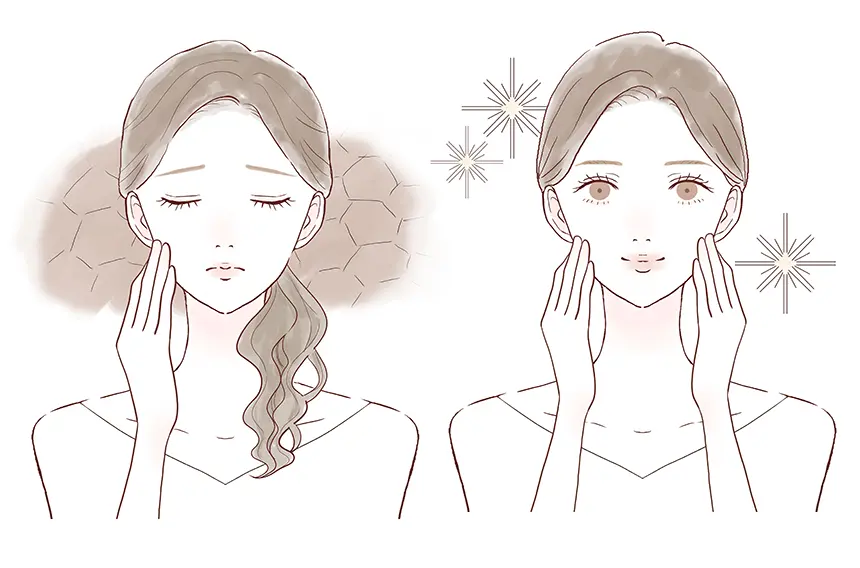 メソナJの症例イラストイメージ