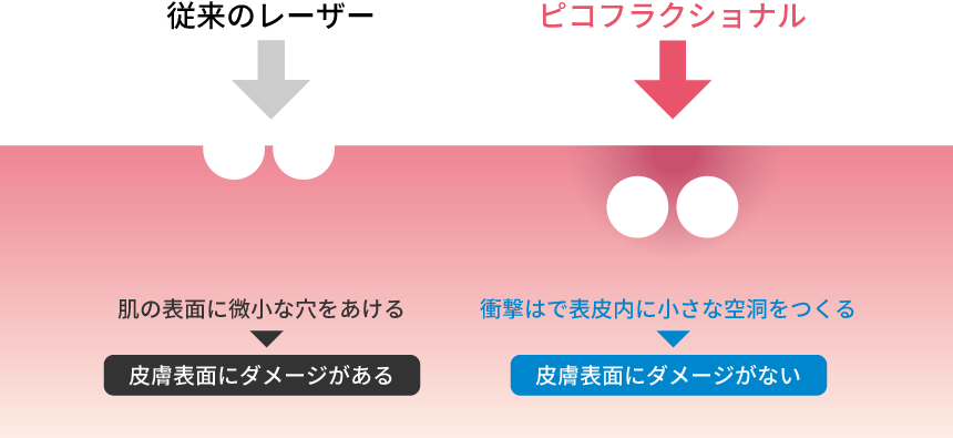 ピコフラクショナル従来との違いの図